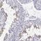 Testis Expressed 13A antibody, NBP2-62675, Novus Biologicals, Immunohistochemistry paraffin image 