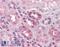 Proprotein Convertase Subtilisin/Kexin Type 6 antibody, NBP1-02307, Novus Biologicals, Immunohistochemistry paraffin image 