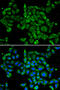 Protein Kinase C Alpha antibody, 13-116, ProSci, Immunofluorescence image 