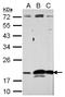 Ribonuclease A Family Member 11 (Inactive) antibody, NBP2-20172, Novus Biologicals, Western Blot image 