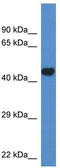 Phosphate Cytidylyltransferase 2, Ethanolamine antibody, TA335473, Origene, Western Blot image 