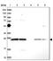 RNA Transcription, Translation And Transport Factor antibody, NBP1-84498, Novus Biologicals, Western Blot image 