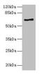 5'-Aminolevulinate Synthase 2 antibody, CSB-PA001560LA01HU, Cusabio, Western Blot image 