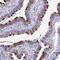 Tetratricopeptide Repeat Domain 30A antibody, NBP2-46792, Novus Biologicals, Immunohistochemistry paraffin image 