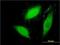 Serum/Glucocorticoid Regulated Kinase 2 antibody, H00010110-M09, Novus Biologicals, Immunocytochemistry image 