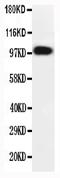 Fibroblast Growth Factor Receptor 2 antibody, PA1241-1, Boster Biological Technology, Western Blot image 