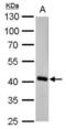 Fumarylacetoacetate Hydrolase antibody, NBP2-16546, Novus Biologicals, Western Blot image 