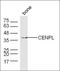 PD-L1 antibody, orb182478, Biorbyt, Western Blot image 