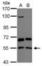 Protein Kinase C And Casein Kinase Substrate In Neurons 2 antibody, PA5-28009, Invitrogen Antibodies, Western Blot image 