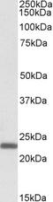 Claudin 14 antibody, STJ70212, St John