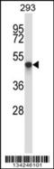 Target Of Myb1 Like 1 Membrane Trafficking Protein antibody, 57-577, ProSci, Western Blot image 