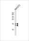 Microtubule Associated Protein 1 Light Chain 3 Beta antibody, LS-C165711, Lifespan Biosciences, Western Blot image 
