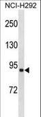 Acyl-CoA Synthetase Long Chain Family Member 1 antibody, LS-C157535, Lifespan Biosciences, Western Blot image 