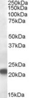 Vacuolar Protein Sorting 25 Homolog antibody, NB100-2468, Novus Biologicals, Western Blot image 