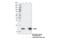 S100 Calcium Binding Protein A9 antibody, 72590S, Cell Signaling Technology, Immunoprecipitation image 