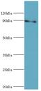 Signal Transducer And Activator Of Transcription 5B antibody, MBS1498231, MyBioSource, Western Blot image 