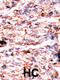 Protein Serine Kinase H1 antibody, 62-708, ProSci, Immunohistochemistry paraffin image 
