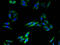 Transmembrane Protein 140 antibody, A63584-100, Epigentek, Immunofluorescence image 