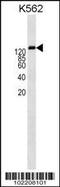 Multidrug resistance protein 1 antibody, 62-130, ProSci, Western Blot image 