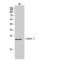 Immunoglobulin Lambda Like Polypeptide 1 antibody, LS-C387725, Lifespan Biosciences, Western Blot image 