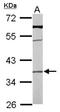 Transmembrane Protein 59 antibody, NBP1-32303, Novus Biologicals, Western Blot image 
