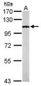 Lysine Acetyltransferase 2B antibody, NBP1-31192, Novus Biologicals, Western Blot image 