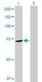 Zinc Finger Protein 133 antibody, H00007692-B01P, Novus Biologicals, Western Blot image 