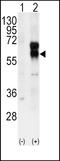 Activin A Receptor Like Type 1 antibody, LS-C97153, Lifespan Biosciences, Western Blot image 