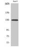 EPH Receptor A2 antibody, A00578Y588-1, Boster Biological Technology, Western Blot image 