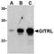 TNF Superfamily Member 18 antibody, TA306245, Origene, Western Blot image 