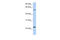 Synaptogyrin 2 antibody, 26-143, ProSci, Western Blot image 