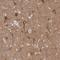 Solute Carrier Family 9 Member A6 antibody, NBP2-32463, Novus Biologicals, Immunohistochemistry frozen image 