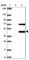 Cytochrome C Oxidase Assembly Factor Heme A:Farnesyltransferase COX10 antibody, HPA032006, Atlas Antibodies, Western Blot image 