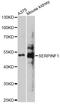 Serpin Family F Member 1 antibody, STJ25489, St John