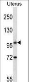 Autophagy Related 9B antibody, LS-C156625, Lifespan Biosciences, Western Blot image 