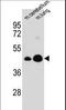 Integral Membrane Protein 2B antibody, LS-C165337, Lifespan Biosciences, Western Blot image 
