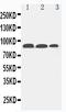 Fibroblast Activation Protein Alpha antibody, PA1913, Boster Biological Technology, Western Blot image 