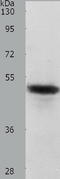 Ceramide Synthase 2 antibody, TA322211, Origene, Western Blot image 