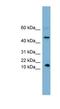 Insulin Like 5 antibody, NBP1-55379, Novus Biologicals, Western Blot image 