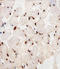 Peroxisome Proliferator Activated Receptor Alpha antibody, LS-C344153, Lifespan Biosciences, Immunohistochemistry frozen image 