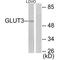 Solute Carrier Family 2 Member 3 antibody, A03259, Boster Biological Technology, Western Blot image 