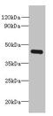 OTU Deubiquitinase With Linear Linkage Specificity Like antibody, CSB-PA873659LA01HU, Cusabio, Western Blot image 