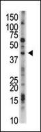 Ubiquitin Specific Peptidase 12 antibody, MBS9202639, MyBioSource, Western Blot image 