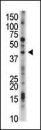 Ubiquitin Specific Peptidase 12 antibody, MBS9202639, MyBioSource, Western Blot image 