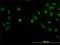 LIM Domain Binding 2 antibody, H00009079-M02, Novus Biologicals, Immunofluorescence image 