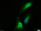 Peroxisome Proliferator Activated Receptor Gamma antibody, GTX03364, GeneTex, Immunofluorescence image 