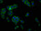 CTR1 antibody, LS-C670309, Lifespan Biosciences, Immunofluorescence image 