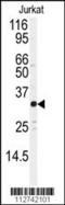 JunD Proto-Oncogene, AP-1 Transcription Factor Subunit antibody, 62-899, ProSci, Western Blot image 