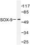 SRY-Box 9 antibody, LS-C176471, Lifespan Biosciences, Western Blot image 