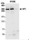 Neurofibromin 1 antibody, NB100-418, Novus Biologicals, Western Blot image 